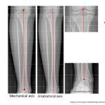 Normal alignment (10)