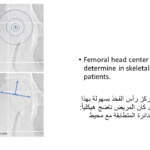 Normal alignment (12)