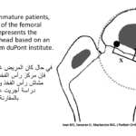 Normal alignment (13)