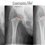 Normal alignment (14)