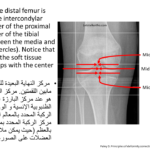 Normal alignment (15)