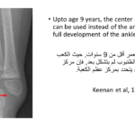 Normal alignment (19)