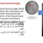 Normal alignment (22)