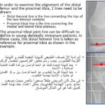 Normal alignment (24)