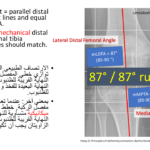 Normal alignment (27)
