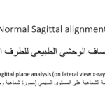 Normal alignment (29)