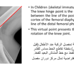 Normal alignment (31)