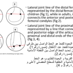 Normal alignment (33)