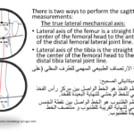 Normal alignment (34)