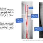 Normal alignment (39)