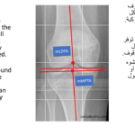 Normal alignment (41)