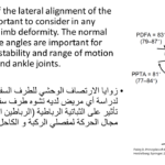 Normal alignment (42)
