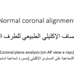 Normal alignment (6)