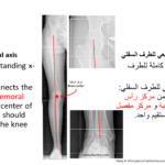 Normal alignment (7)