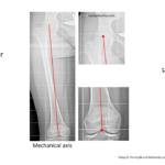 Normal alignment (8)