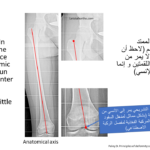 Normal alignment (9)